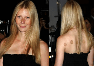 paltrow cupping